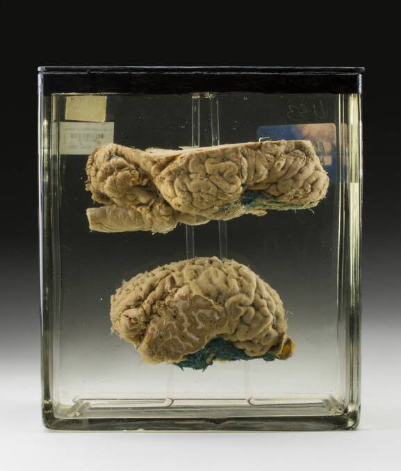 A horse brain from the Australian Institute of Anatomy's specimen collection, dated 1933.