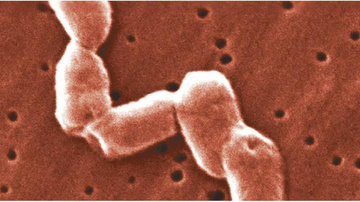 Salmonella virus. Photo: Centers for Disease Control and 