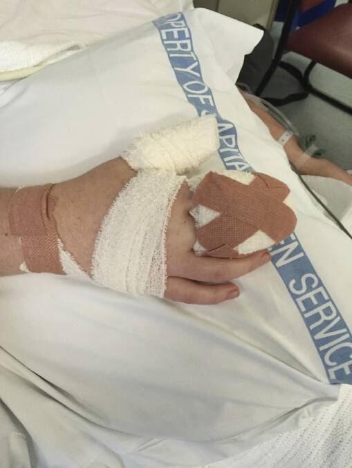 Isabelle Goldstraw's hand after the attack. Photo: Supplied