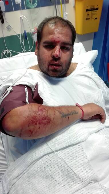 Mr Sachdeva said his confidence was shaken after allegedly being struck in the head and racially abused. Photo: Supplied