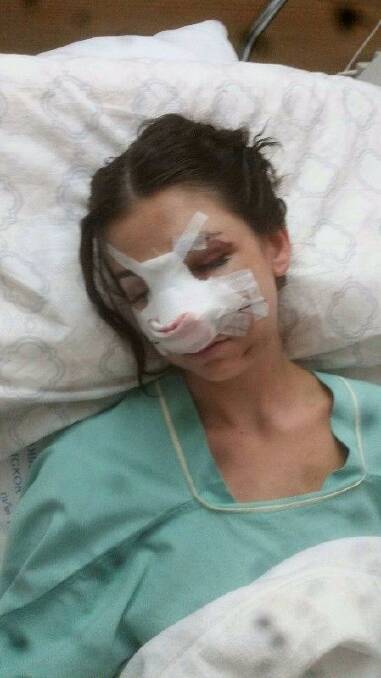 Shani suffered severe injuries to her face during the crash. Photo: Supplied