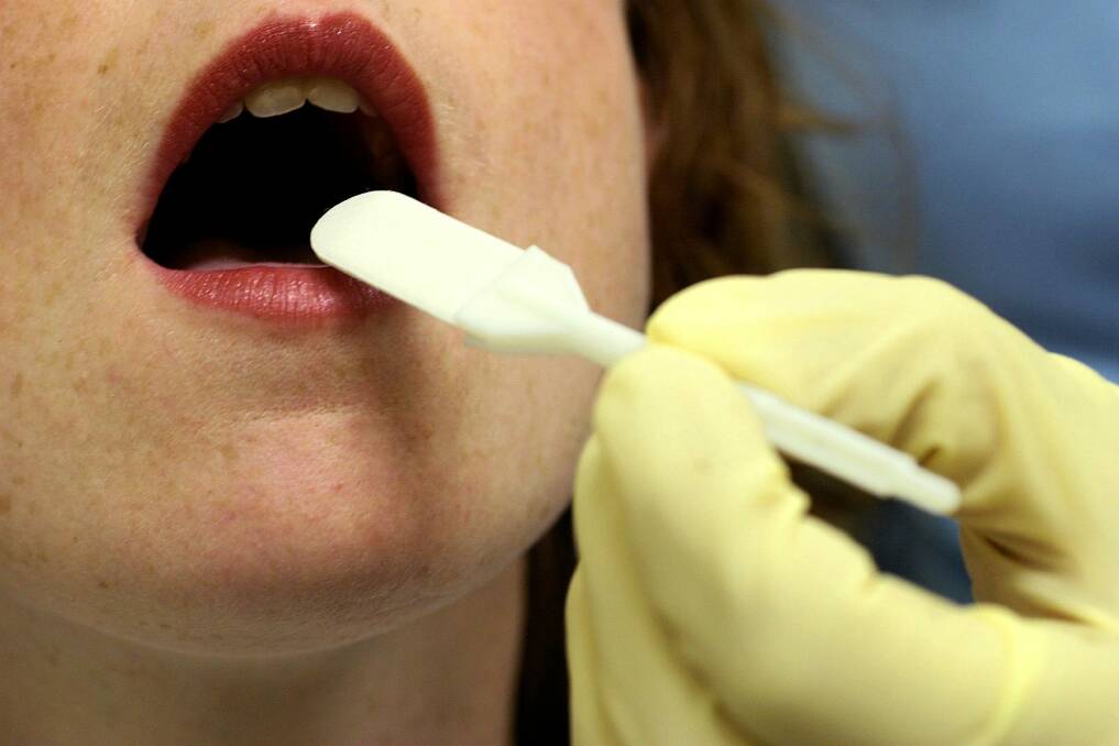 Swab test: Courts have found the type of test - urine or saliva - affects its legality. Photo: Ken Irwin