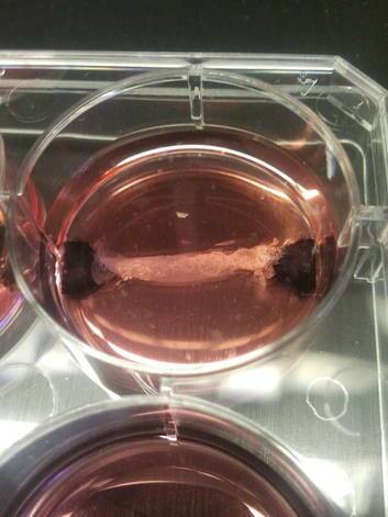 A Petrie Dish with meat being grown from stem cells by Professor Mark Pace of Maastricht University. Photo: Supplied