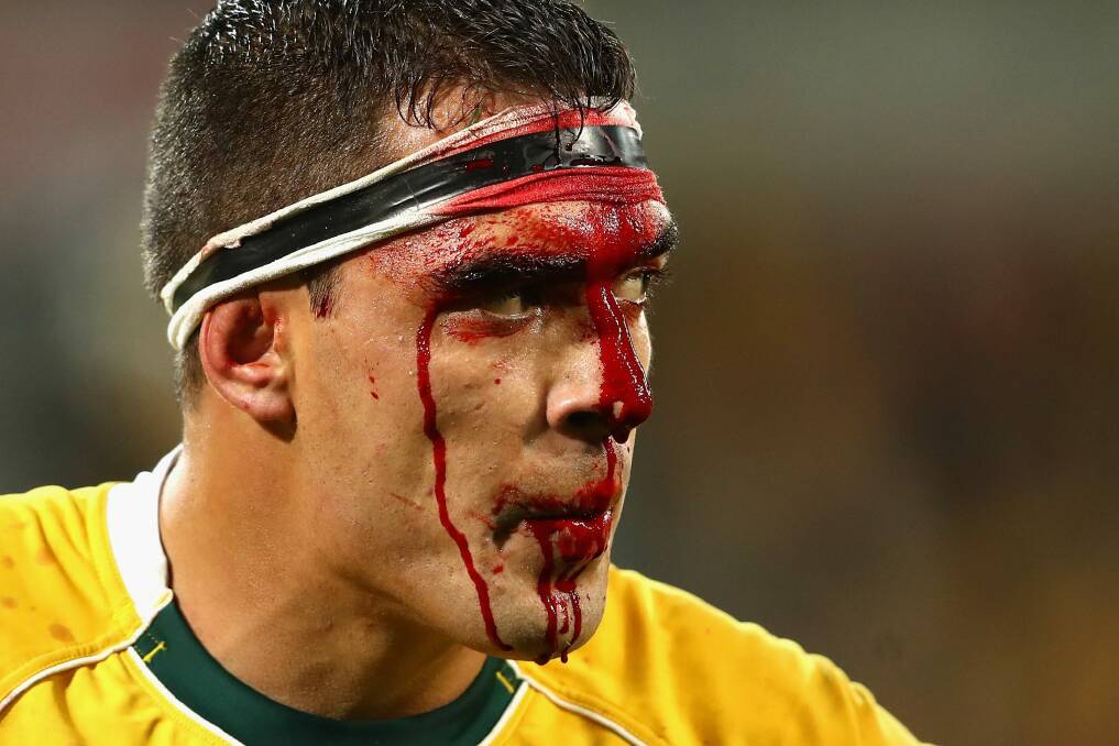 Split open: Wallabies forward Rory Arnold bleeds from his head during the Test between the Wallabies and England at AAMI Park. Photo: Cameron Spencer