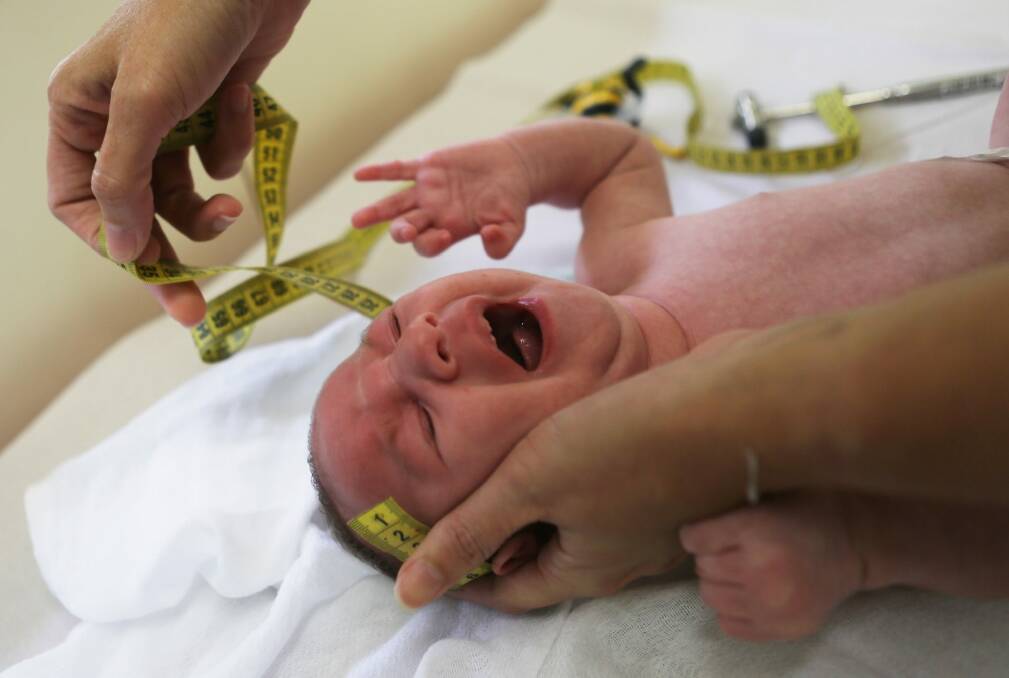 A doctor in Brazil measures the head of a two-month-old baby with microcephaly. Photo: Getty Images