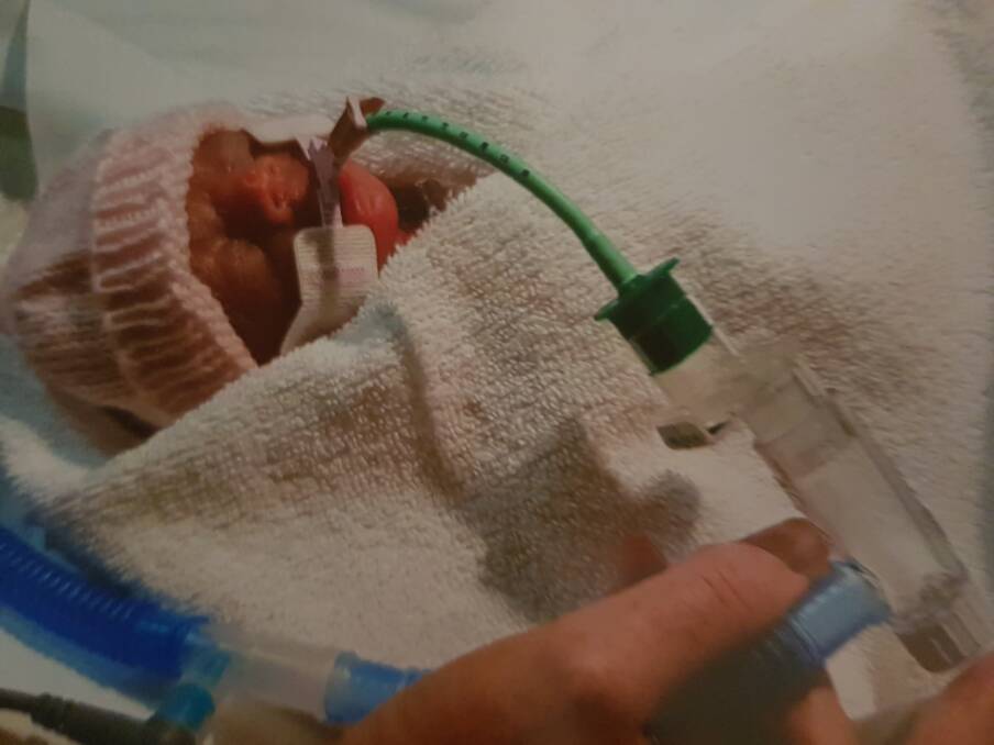 Angelina Doreski at birth. She was born at 25 weeks and two days, weighing just 690 grams. Photo: Supplied