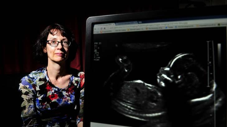 University of Canberra centenary resident professor of faculty arts and design Deborah Lupton talks about parents showing ultrasound's of their children on social media. Photo: Melissa Adams