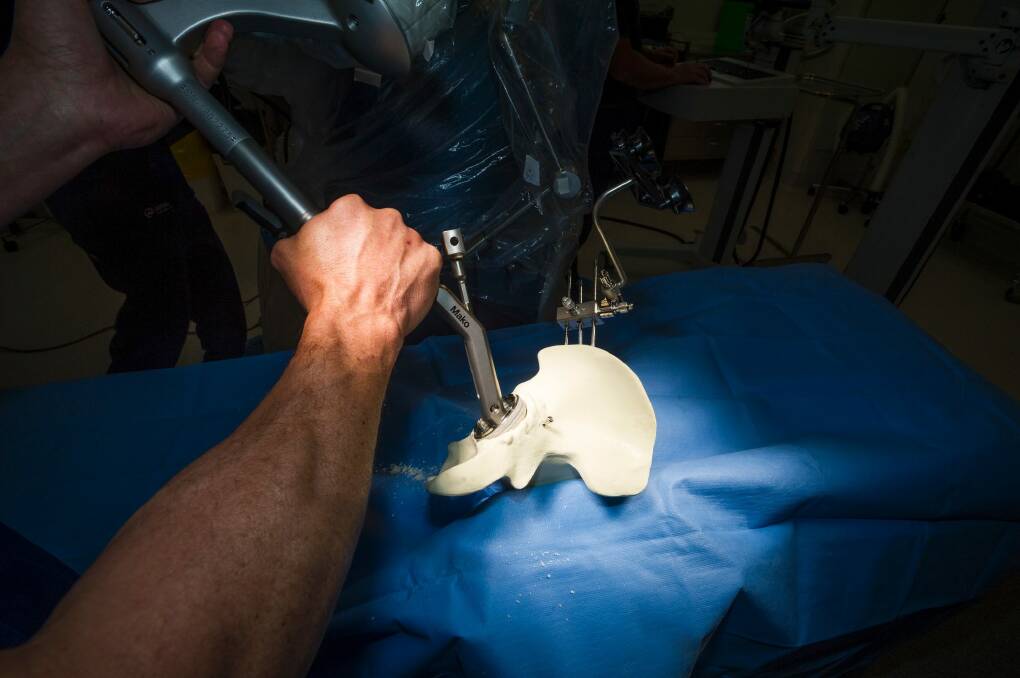 Damian Smith demonstrating how the robotic arm would function in a hip surgery. Photo: Dion Georgopoulos Photo: Dion Georgopoulos