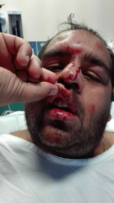 He will undergo CT scans on Monday afternoon to assess the damage to his face. Photo: Supplied