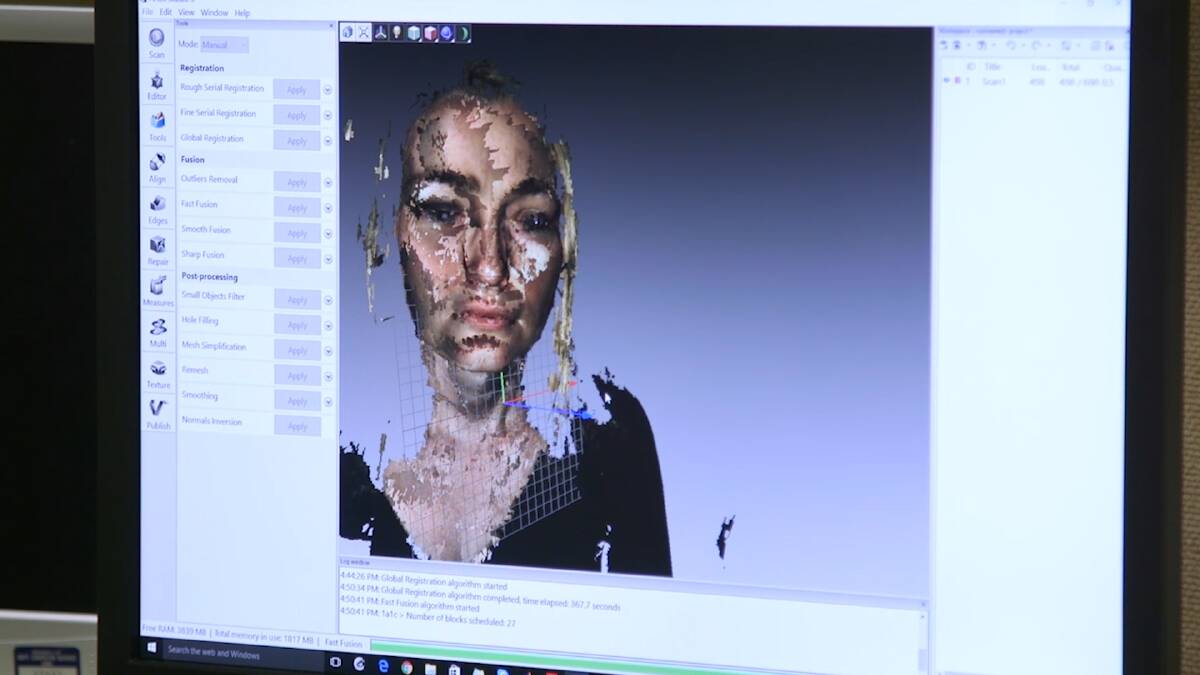 Researchers at the University of Western Australia have produced a new 3D imaging system that aims to provide patients considering facial cosmetic procedures with an accurate prediction of the results. Photo: supplied
