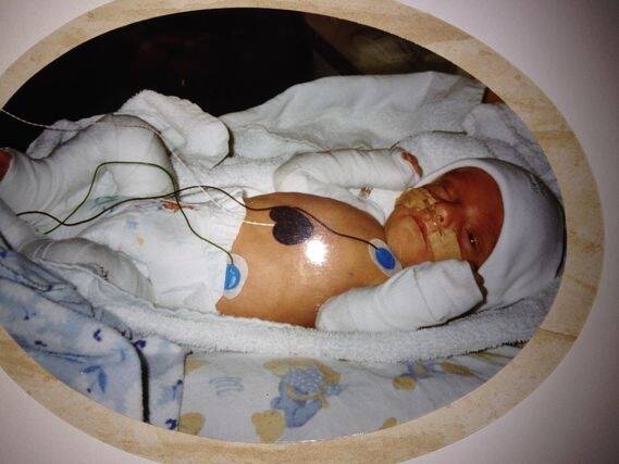 Jake Harrington at nine days old, after having his first heart operation.  Photo: Supplied