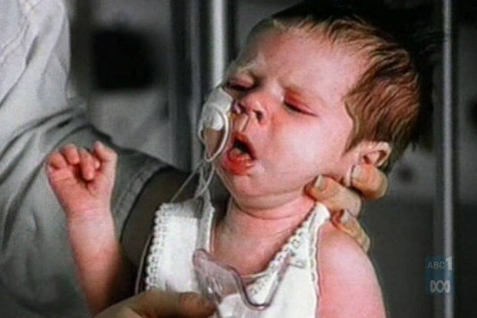 A baby with whooping cough. Photo: Supplied