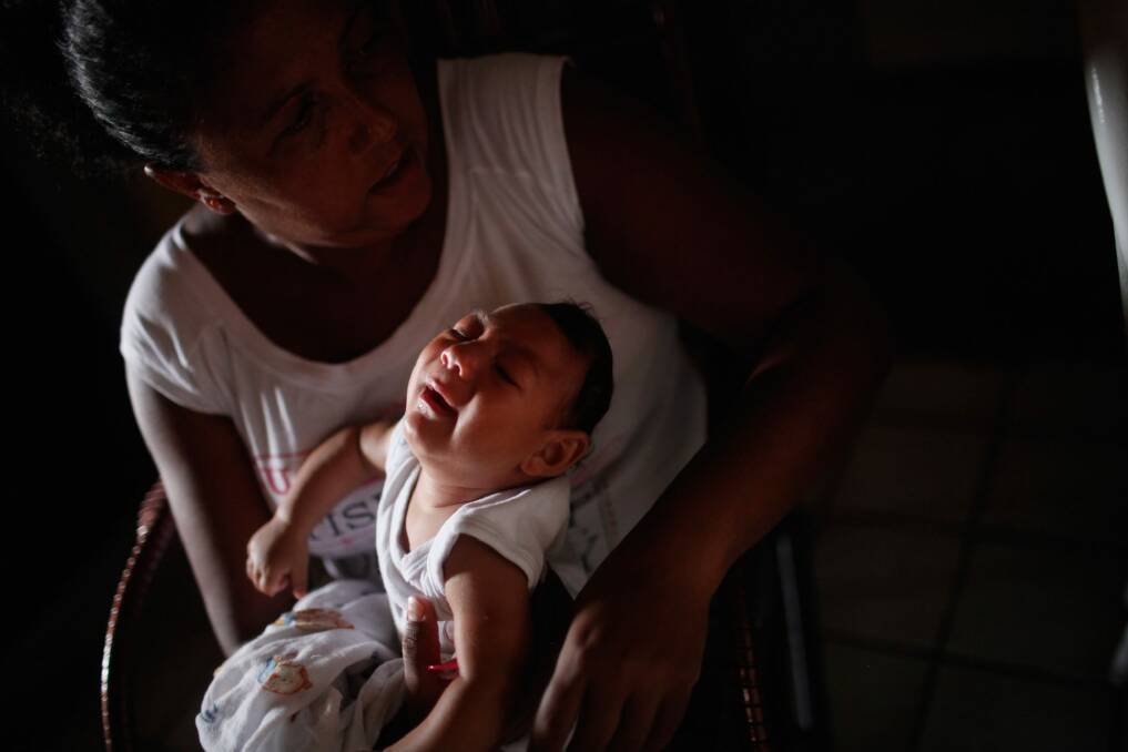 Three-month-old Alice Vitoria Gomes Bezerra, who has microcephaly, is held by her mother Nadja Cristina Gomes Bezerra in Recife, Brazil. In the last four months, authorities have recorded close to 4000 cases in Brazil in which the mosquito-borne Zika virus may have led to microcephaly in infants. The ailment results in an abnormally small head in newborns and is associated with various disorders including decreased brain development.  Photo: Getty Images