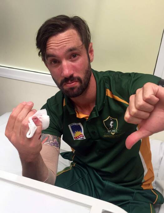 Ouch!: Jono Dean in hospital after dislocating his pinky finger in the regional Twenty20 final. Photo: Supplied