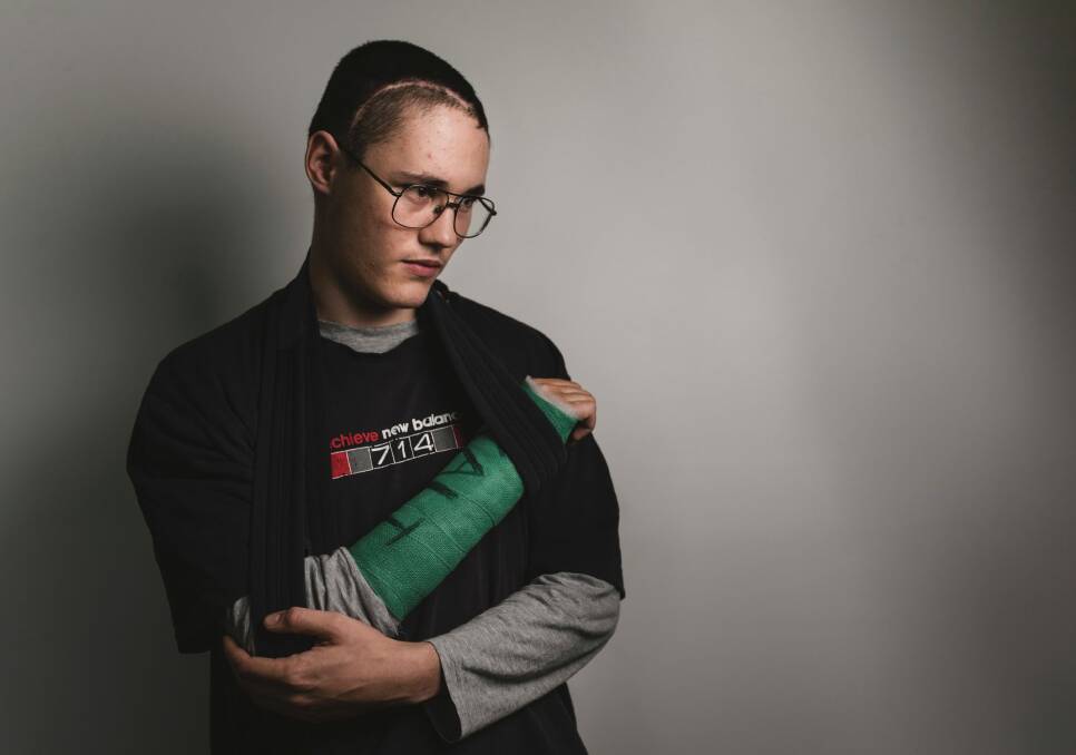 Patrick, fell off his skateboard at high speed, hitting his arm and head. He was treated for a broken wrist and sent home without being checked for head injuries Photo: Jamila Toderas