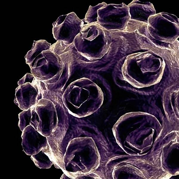 A measles virus under a microscope. Photo: Supplied