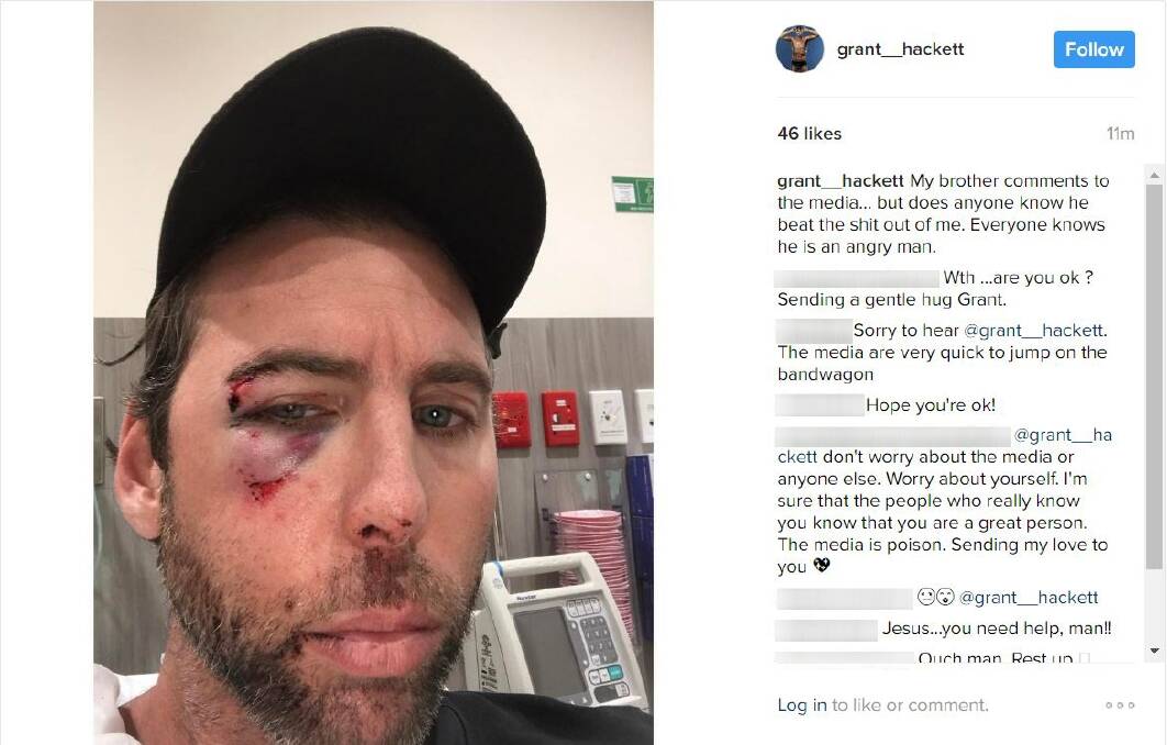Grant Hackett has posted an image of himself to social media, his face bloody and bruised. Photo: Instagram