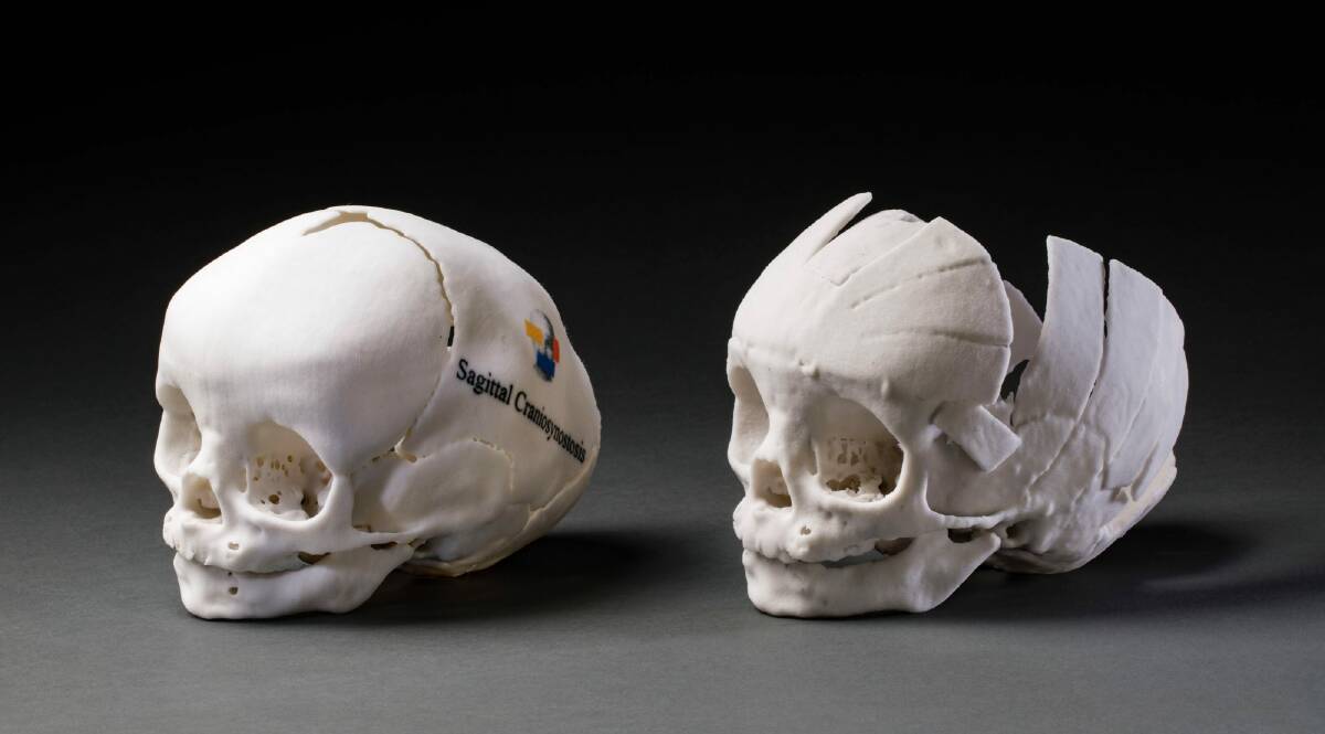 Surgeon Professor David David chose models of skulls taken from patient CT scans. Photo: Jason McCarthy