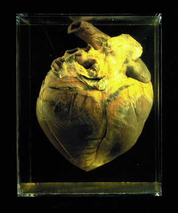 Phar Lap's heart, stored at the Institute of Anatomy in Canberra. Photo: National Museum Of Australia