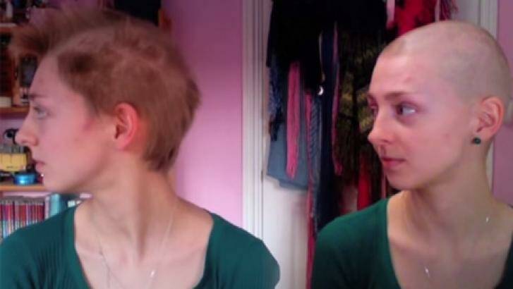 Ms Brown decided to shave her head to disguise the illness when she was 19. Photo: YouTube