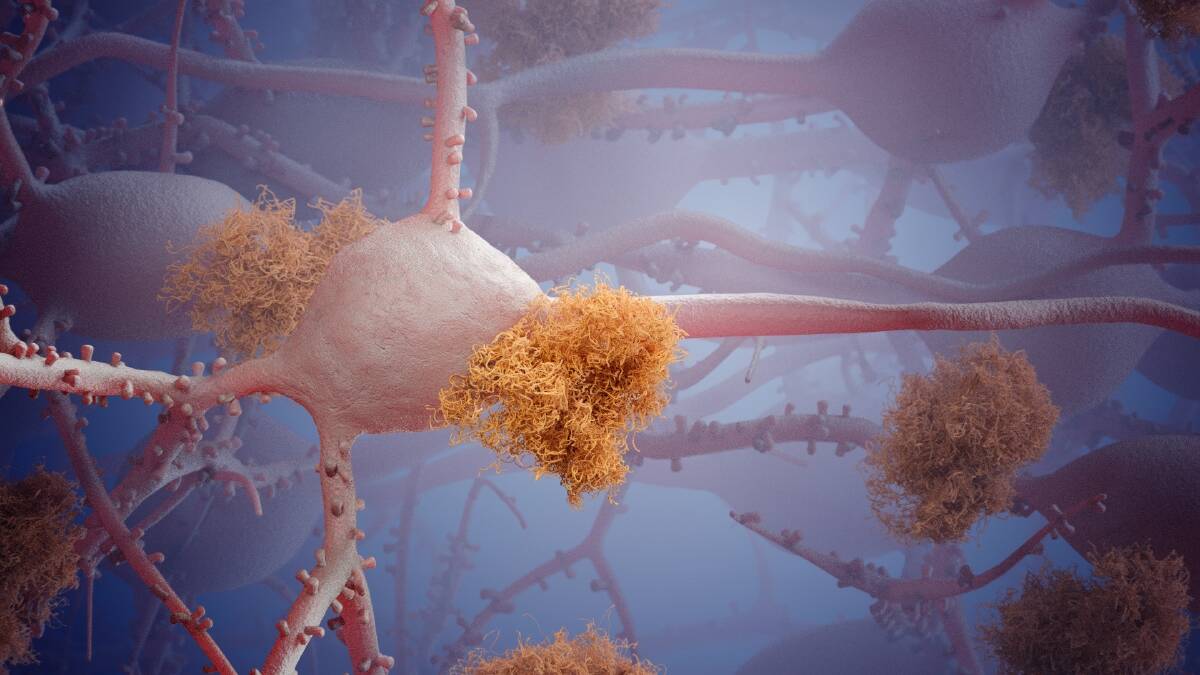 Stills from Chris Hammang's Alzheimer's Enigma 3D biomedical animation exploring the neurons of the human brain. Photo: act\clare.colley