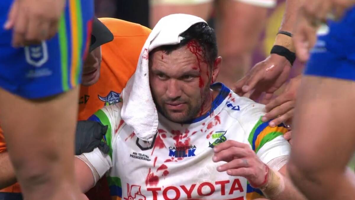 Jordan Rapana was left bloodied after a knee to the head in Brisbane. Picture Fox Sports