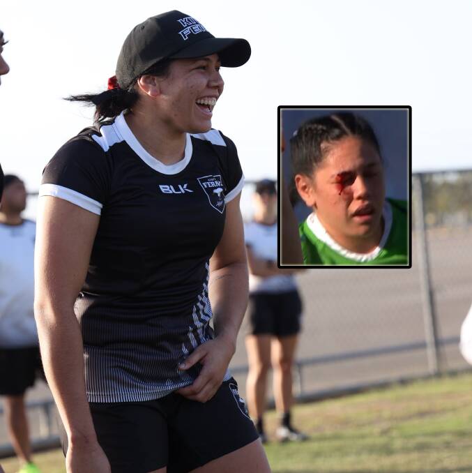 Cheyelle Robins-Reti at Kiwi Ferns camp, and inset, her facial fracture. Picture NZRL