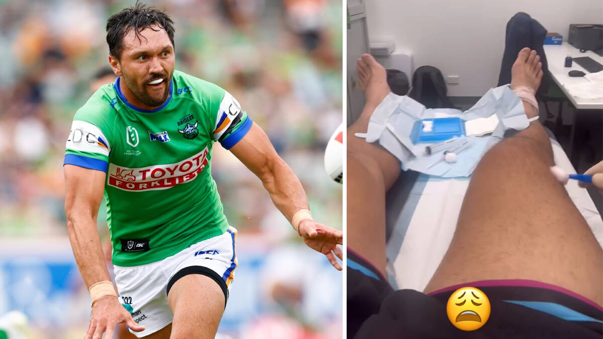 Jordan Rapana shared an update of his knee injury on social media. Picture Instagram
