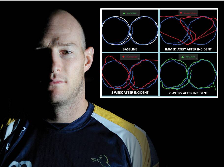 Brumbies great Stirling Mortlock is backing a program which can revolutionise concussion testing. Pictures by Lannon Harley/Supplied