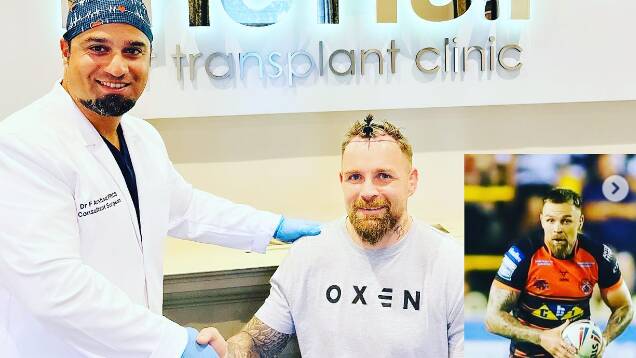Blake Austin's hair transplant will be live streamed. Picture Instagram