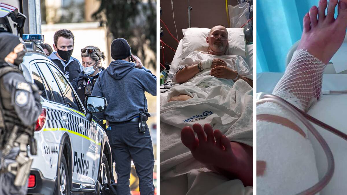 Police at the hotel after the incident, left, and Peter Hill in his hospital bed after hours of surgery. Pictures: Karleen Minney, Supplied 
