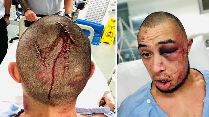 David Laipato after he was "bashed". Picture: Supplied