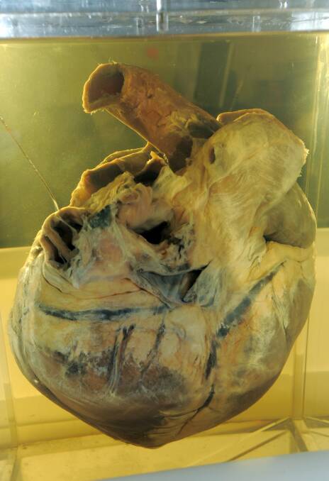 Phar Lap's preserved heart, part of the National Museum's permanent historic collection. Picture: Supplied
