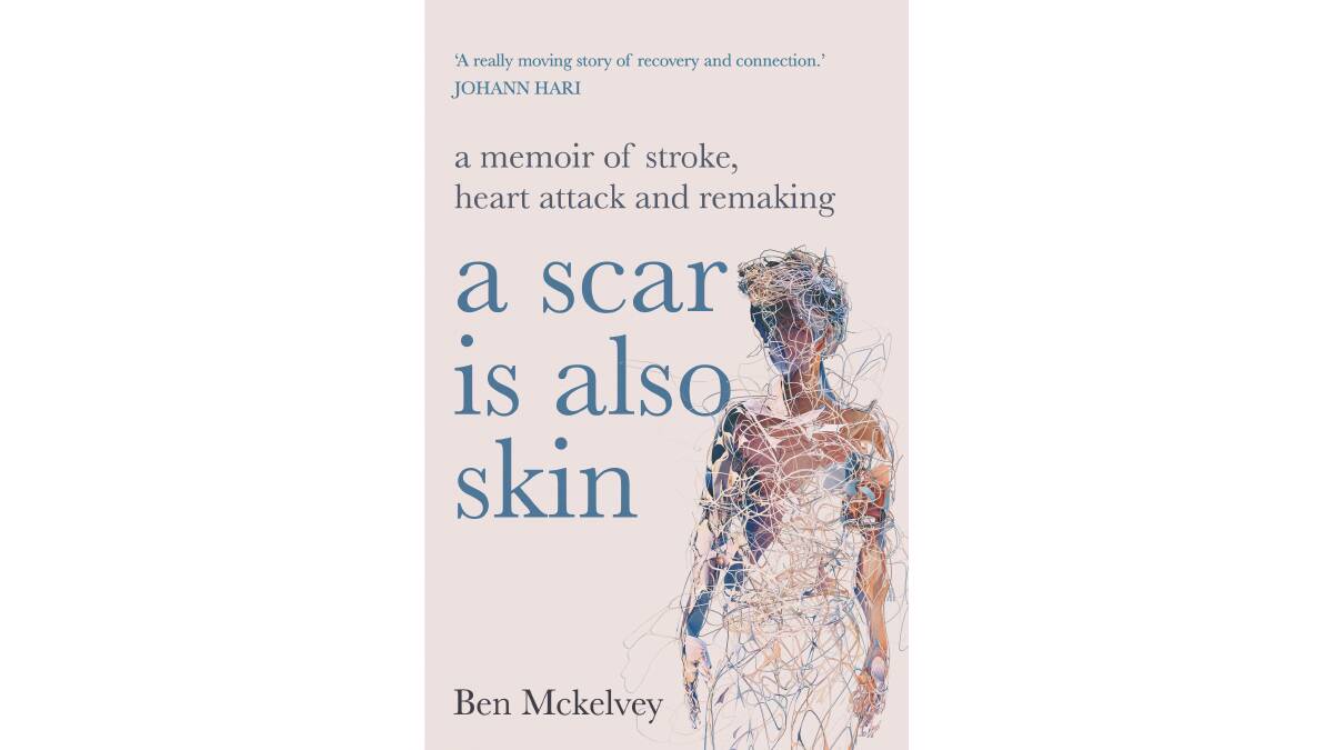 A Scar is Also Skin, by Ben Mckelvey. 