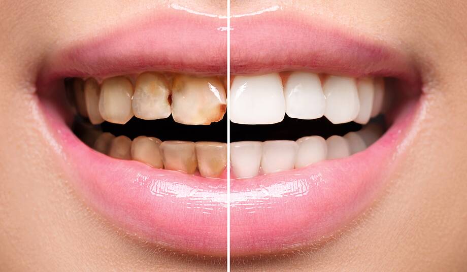 Cosmetic surgery and dentistry are among the most popular treatments. Picture Shutterstock