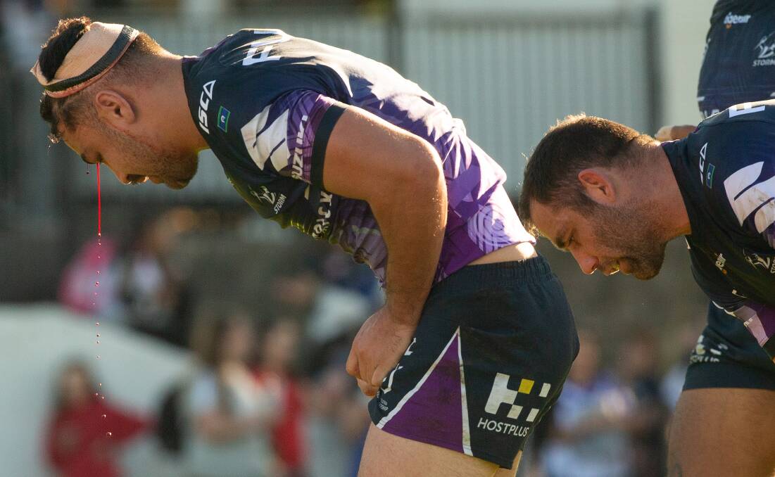Jahrome Hughes of the Storm gets tackled and bleeds from the head. Picture: AAP