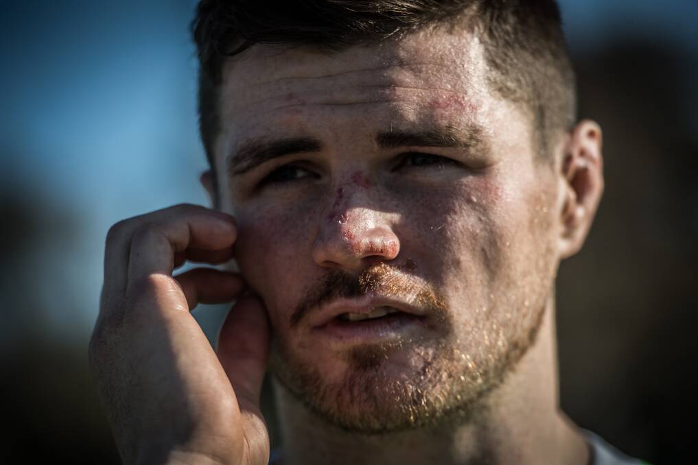Canberra Raiders second-rower John Bateman faces a race to be fit for round one. Picture: Karleen Minney