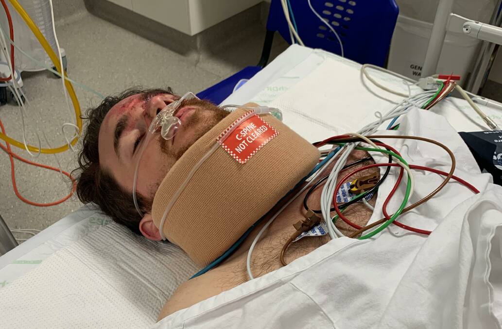 Tom Cumming broke his neck, three ribs, his shoulder and suffered two brain bleeds after a night out. Picture: Supplied.