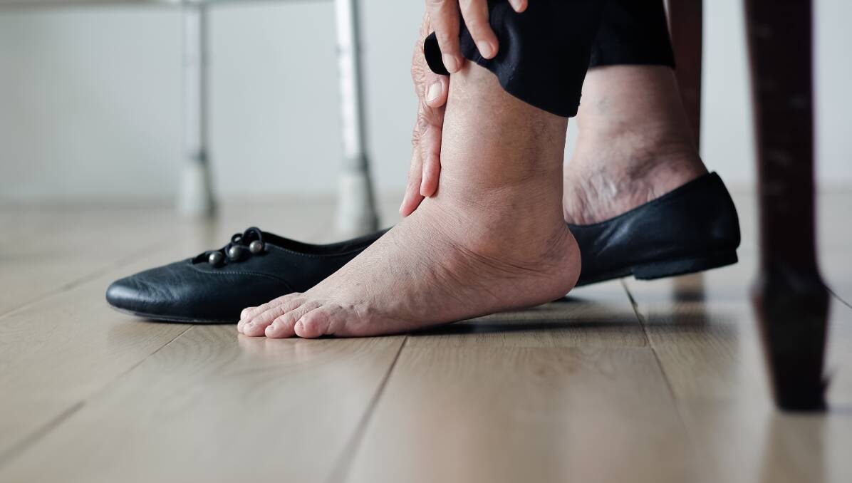 Examine your feet daily, particularly if you start losing sensation. Picture: Shutterstock.