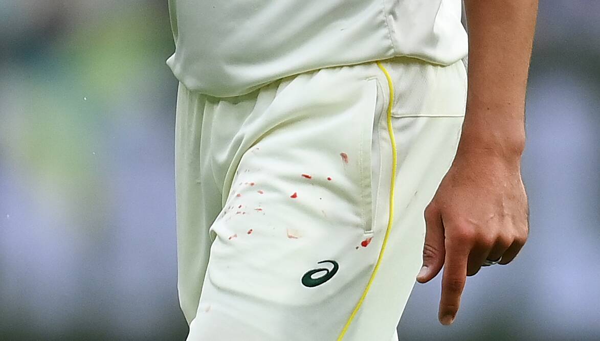 Mitchell Starc's blood-stained trousers during the second Test. Picture Getty Images