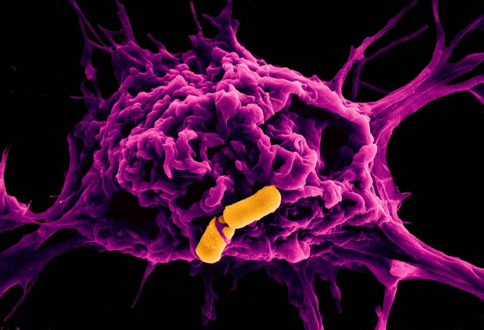 The battle as a purple immune cell tries to devour an invading stomach bug (the yellow rod-shaped bacteria). Photo: Australian National University