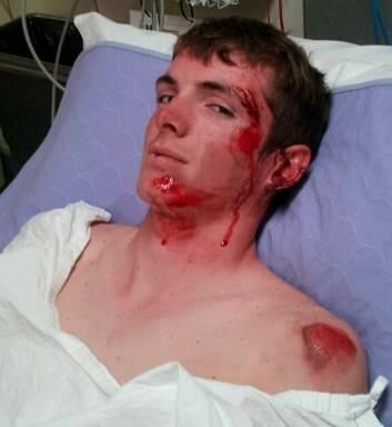 Brayden Clews-Proctor after a bike accident in October 2012.