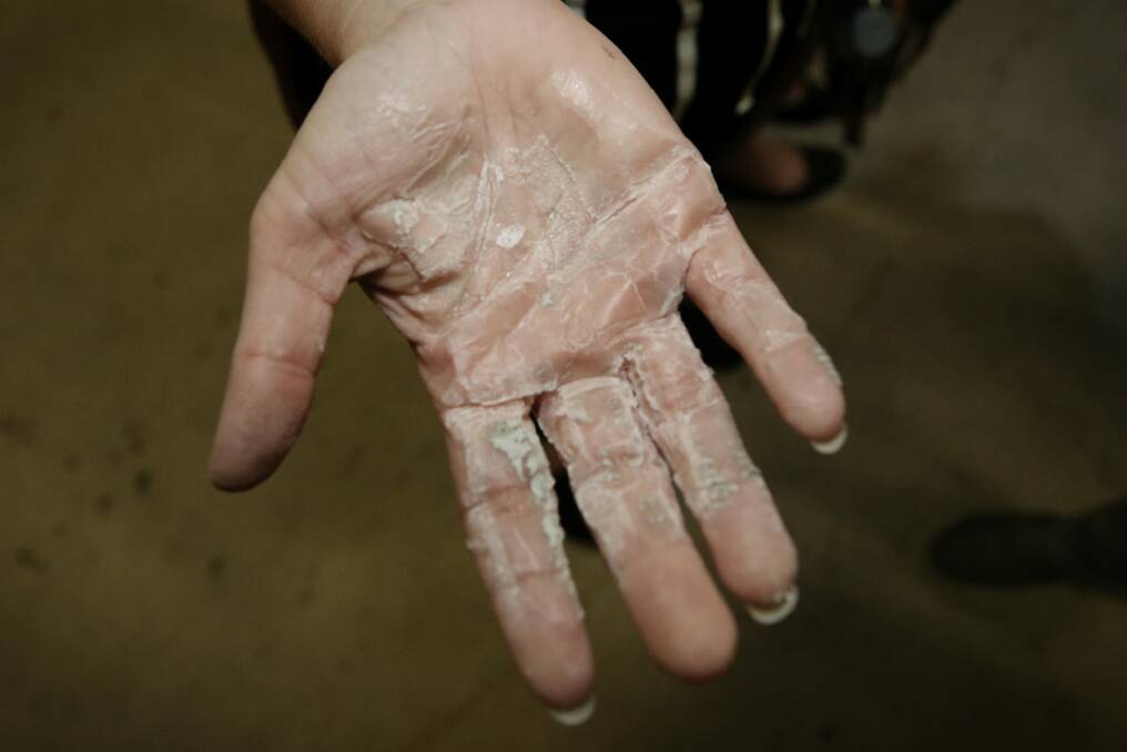 One of the protester's hands after it was pulled from the balustrade.  Photo: Andrew Meares
