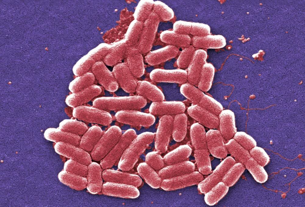 Superbugs, such as E.coli are resistant to many antibiotics Photo: CDC/AP