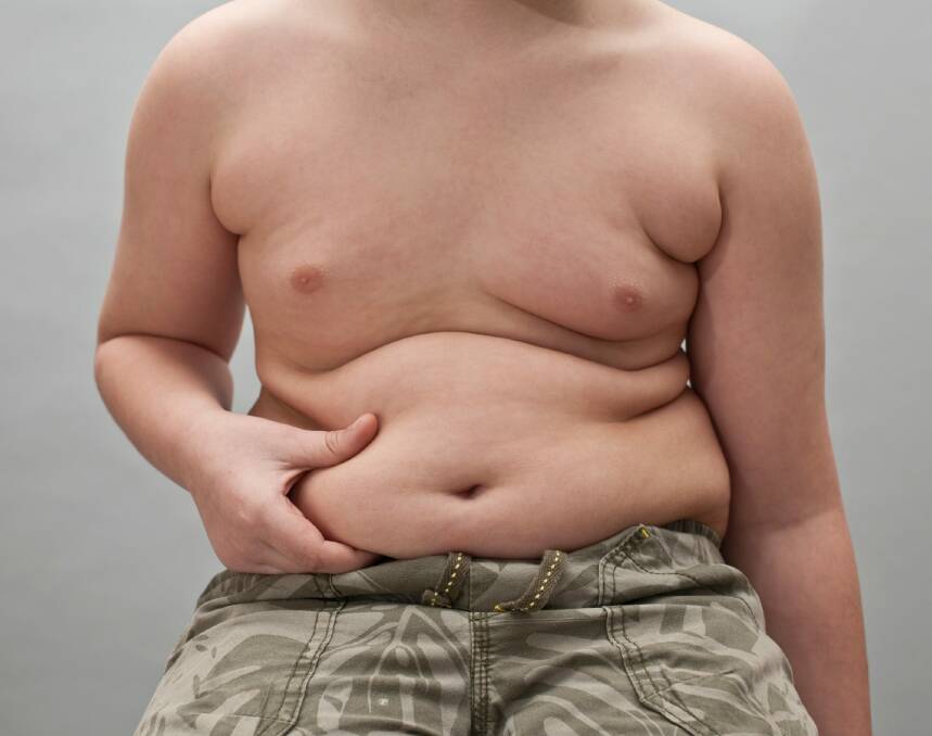 Childhood obesity: Who's to blame?  Photo: Getty Image