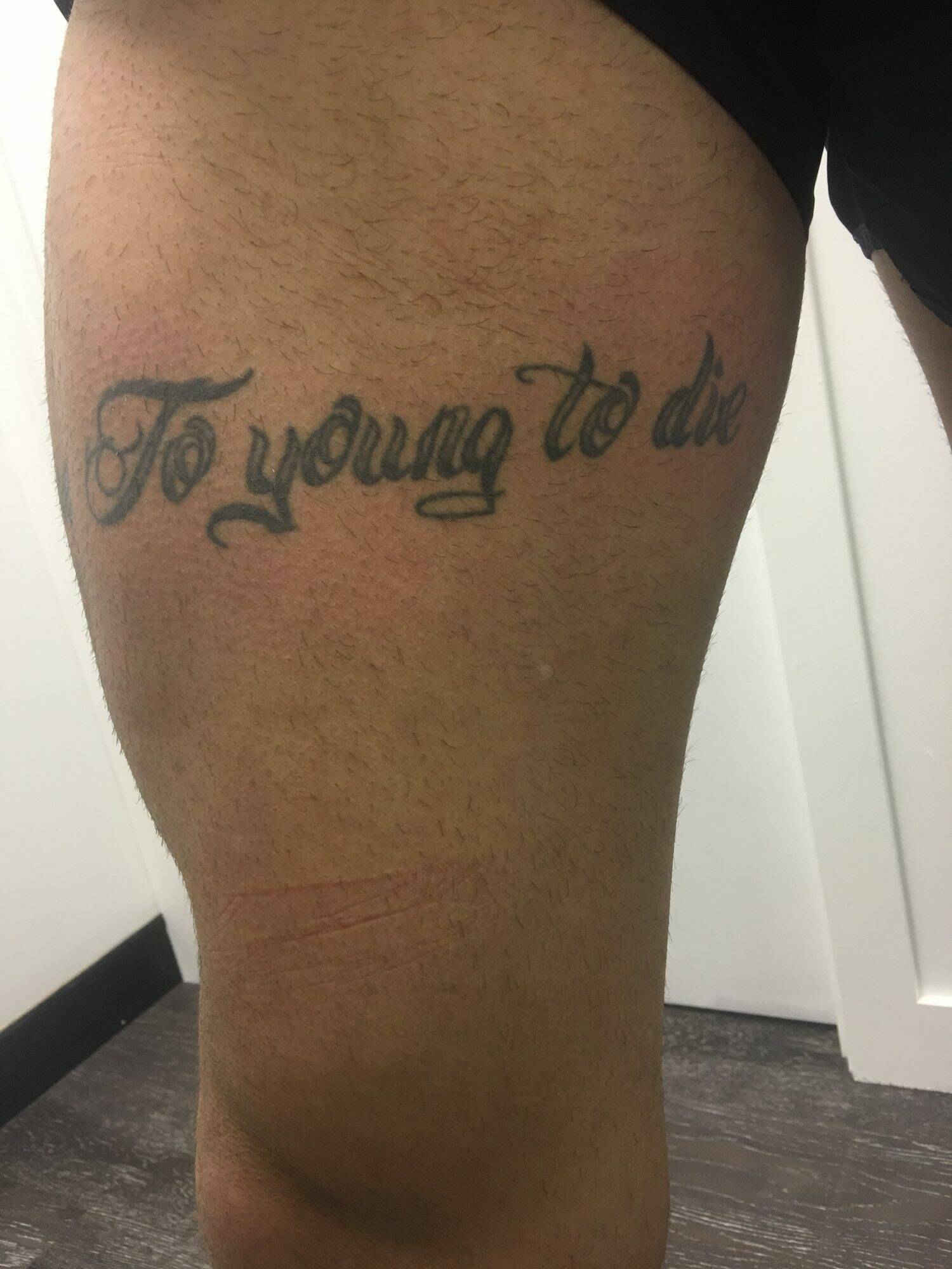 Canberra tattoo removal business booming thanks to 'ragrets' and spelling  fails | The Canberra Times | Canberra, ACT