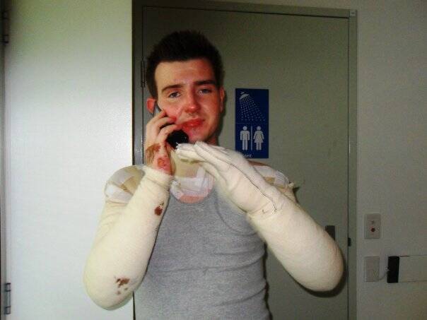 Paul Fennessy in hospital after the gas explosion, just three months before he died in 2010. Photo: Supplied