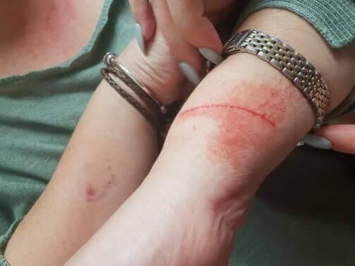 A nurse was assaulted at the adult mental health unit this week.  Photo: Supplied