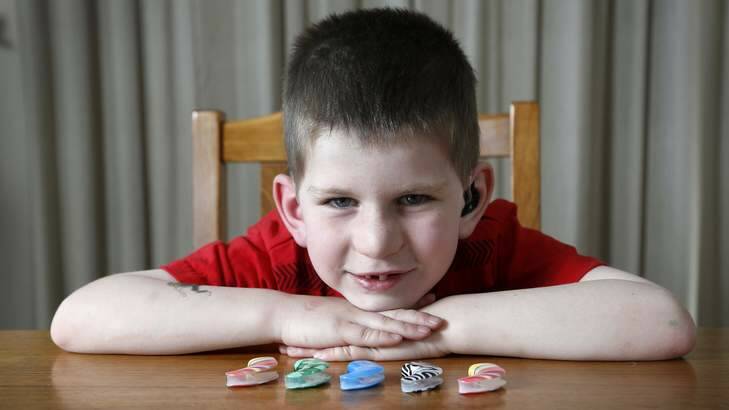 Liam Denny 5 from Gilmore shows of his coloured sound processor covers for his cochlear implant that he calls his "magic ears." Photo: Jeffrey Chan