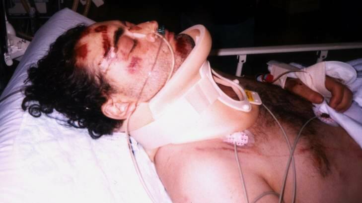 Confined to a wheelchair ... Jonathan Crowley after he was shot. Photo: Supplied